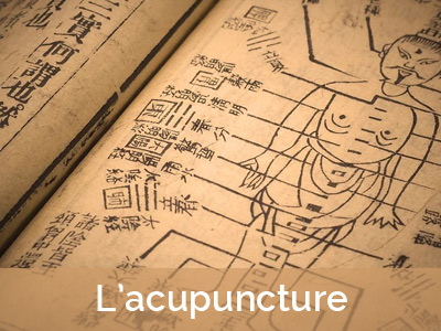 L'acupuncture en médecine traditionnelle chinoise