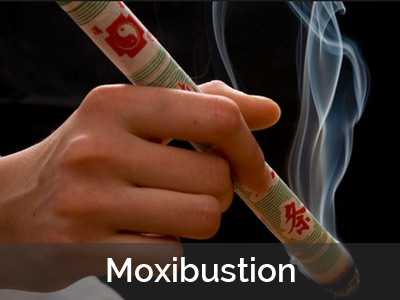 La moxibustion en médecine traditionnelle chinoise